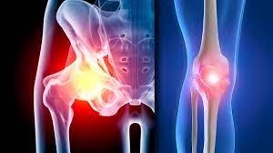 Best Joint Replacement Surgery Doctor in Goregaon